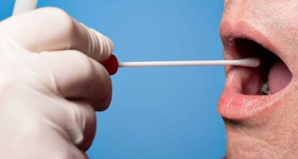 HOY / Una lesión bucal que persiste por 15 días puede ser señal de un cáncer