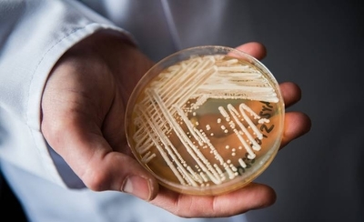 HOY / Brasil detecta primer posible caso de infección por hongo potencialmente mortal