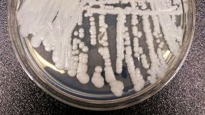 Brasil reporta su primer posible caso de infección con el peligroso hongo Candida auris