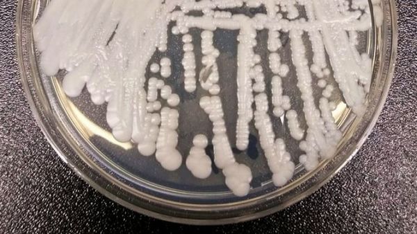 Brasil reporta su primer posible caso de infección con el peligroso hongo Candida auris