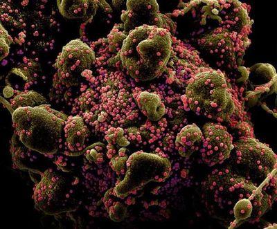 Los casos del virus en todo el mundo superan los 68,75 millones y las muertes se elevan a 1.566.985
