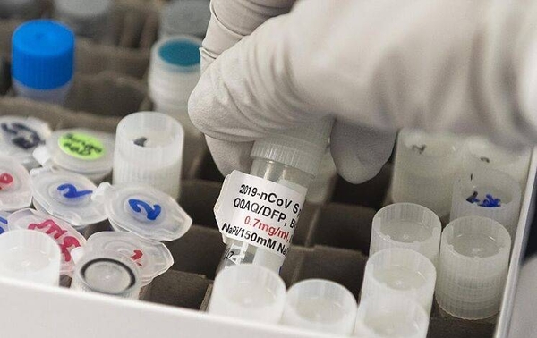 HOY / Suspenden pruebas de vacuna australiana tras falsos positivos de VIH