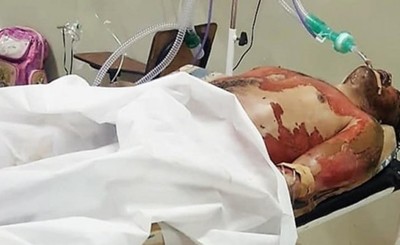 Muere tras prenderse fuego en el calabozo de una comisaría
