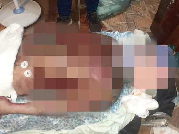 Drogadicto se prendió fuego dentro del calabozo de comisaría