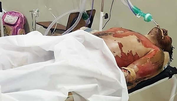 Muere tras prenderse fuego en el calabozo de una comisaría - Noticiero Paraguay