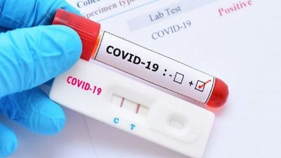 10 posibles casos de reinfección en estudio