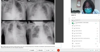 La Nación / Taiwán capacita a médicos paraguayos del Hospital de Clínicas