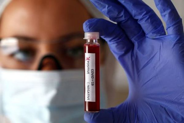 Salud Pública informa sobre 18 muertes y 819 nuevos contagios por coronavirus