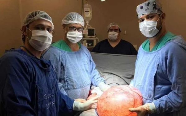 Extirpan quiste gigante en hospital de Presidente Franco