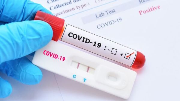 Covid-19: Salud reporta 18 muertes y 1.268 nuevos casos confirmados