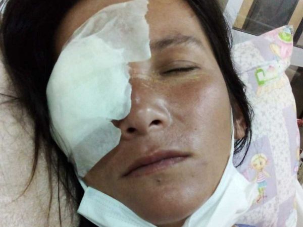 Garza le picoteó en el ojo y se está quedando ciega