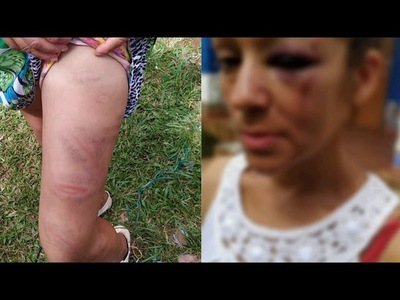 MUJER DENUNCIA QUE FUE BRUTALMENTE GOLPEADA POR UN AGENTE POLICIAL
