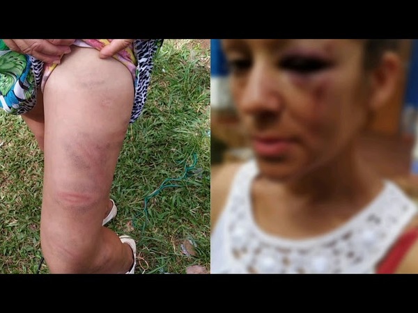 MUJER DENUNCIA QUE FUE BRUTALMENTE GOLPEADA POR UN AGENTE POLICIAL