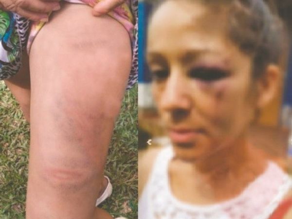 Mujer acusa a policía de molerle a golpes
