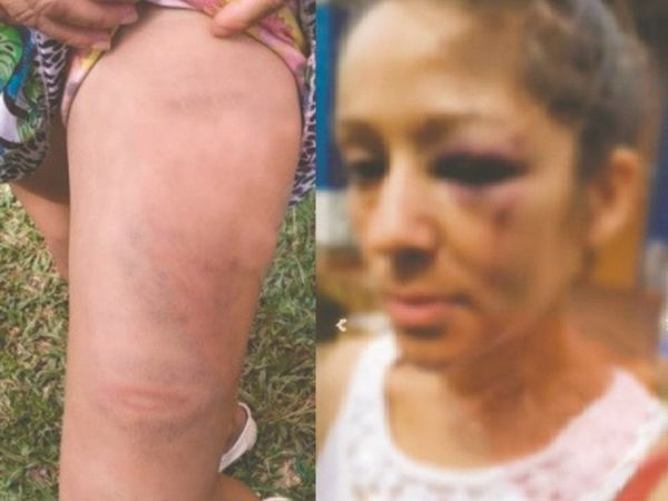 Mujer acusa a policía de molerle a golpes