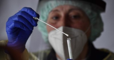 La Nación / COVID-19: 632 positivos y 16 fallecidos reporta Salud, este domingo