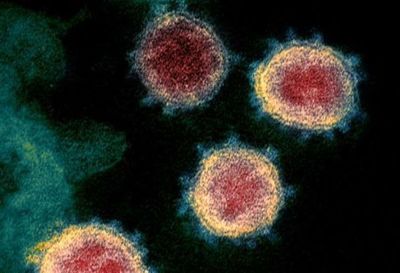 Covid-19: Sudáfrica investiga otra variante del patógeno vinculada a su segunda ola de infecciones