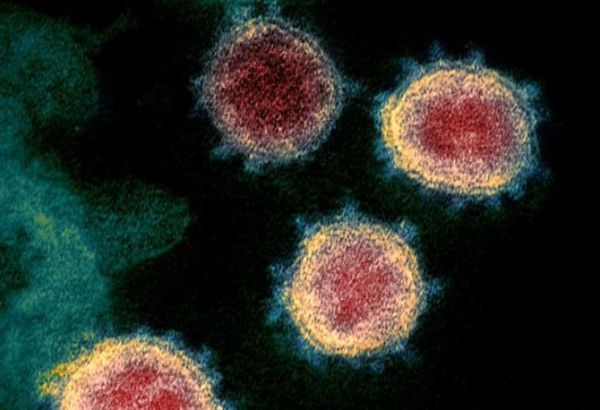 Covid-19: Sudáfrica investiga otra variante del patógeno vinculada a su segunda ola de infecciones
