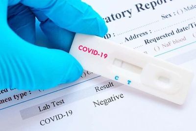Salud Pública registra 18 nuevas muertes y 827 contagios por coronavirus