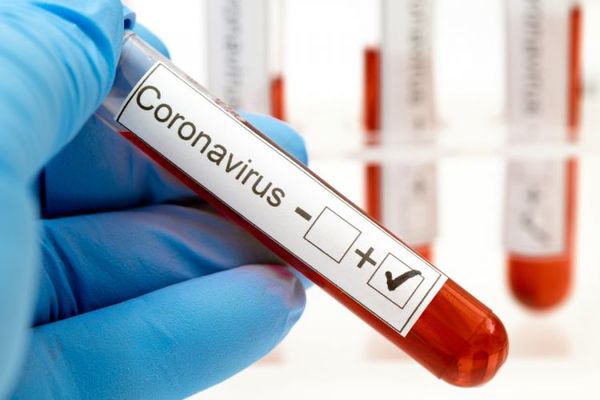 Salud reporta 559 nuevos casos positivos de coronavirus