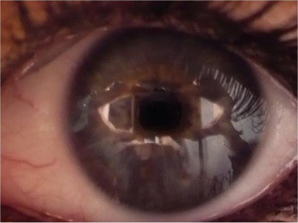 Científicos resucitarán ojos de fallecidos para experimentar con ellos