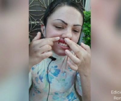 AUDIO: Relato de Leticia Fleitas tras brutal agresión de parte del concejal Martín Pocho en PJC