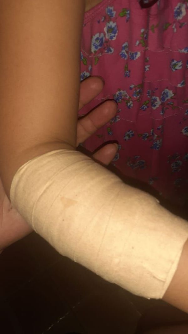 Perro muerde a niña en San Antonio - Nacionales - ABC Color