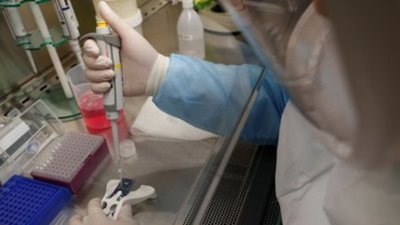 India afirma que se convirtió en el primer país en lograr "aislar y cultivar con éxito" nueva cepa de Covid » Ñanduti