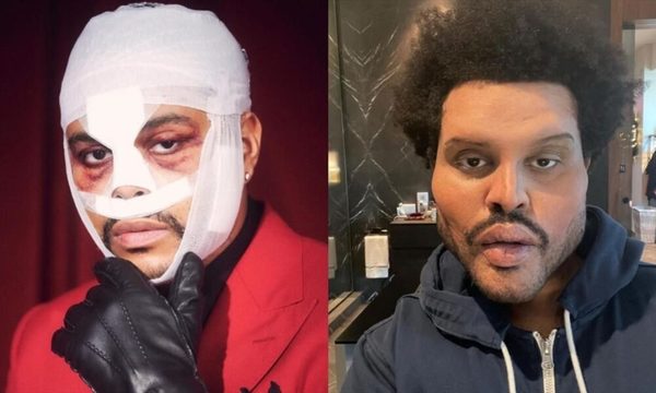The Weeknd sorprende con su dramático cambio de look