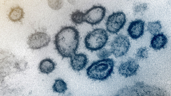 Director del Senepa aclara que casos sospechosos de dengue y Covid-19 no están confirmados aún - ADN Digital
