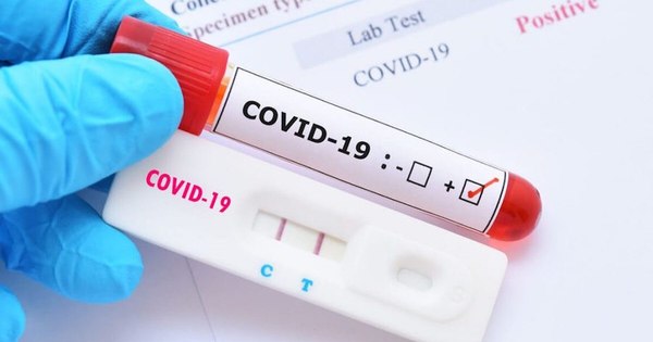 La Nación / COVID-19: inmunidad protegería ante reinfecciones al menos 8 meses, según estudios