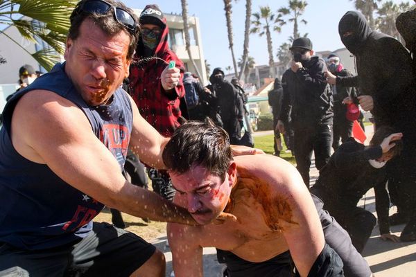 Manifestantes a favor y en contra de Trump se enfrentan en San Diego - Mundo - ABC Color