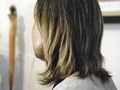 Doña le rompió la cabeza a la joven que tenía a su cargo