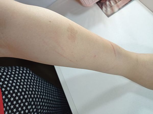 2021 mbohapy feminicidio: Oikuaauka umi señal oïva violencia kuñáre - ABC Remiandu - ABC Color