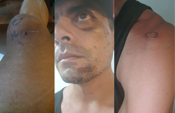 Ciclista sufre brutal accidente tras caer en un bache en Luque » Ñanduti
