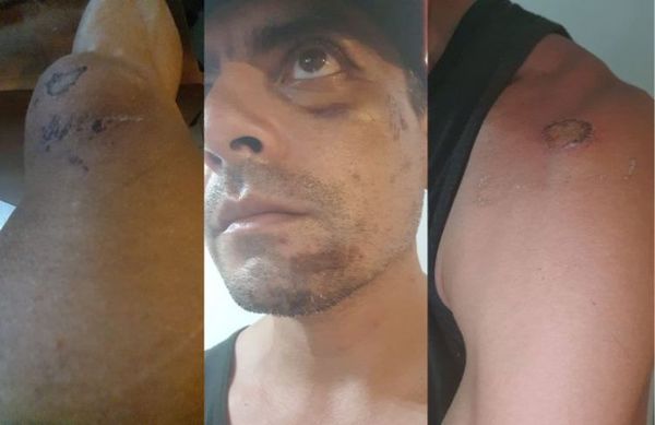 Ciclista sufre brutal accidente tras caer en un bache en Luque