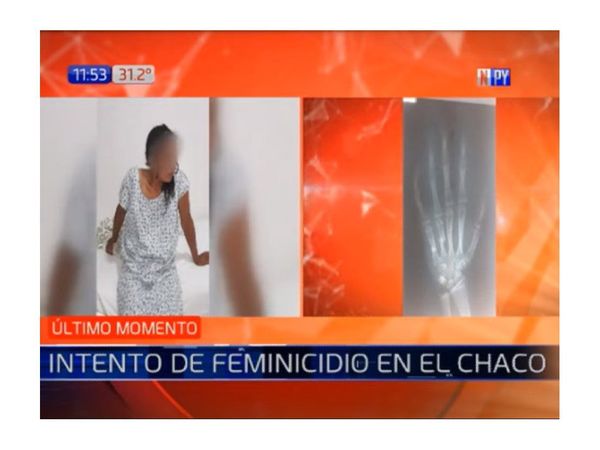 Intento de feminicidio en Benjamín Aceval