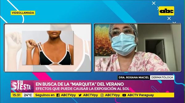 En busca de la “marquita” del verano - Efectos que puede causar la exposición al sol (Parte 1) - Ensiestados - ABC Color