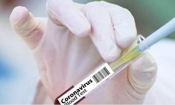 Congreso sanciona Ley para compra de vacunas anti Covid-19