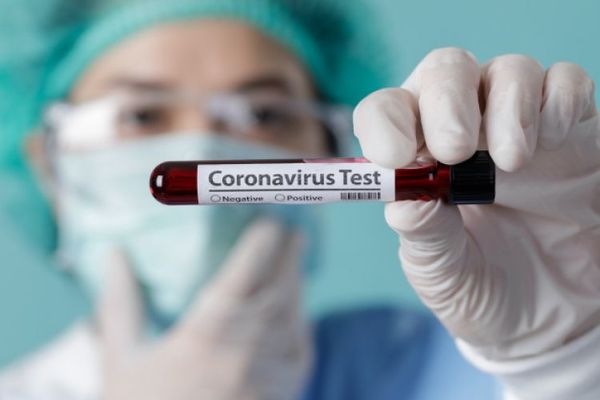 Salud Pública registra 14 muertes y 1.002 nuevos contagios por coronavirus en el país