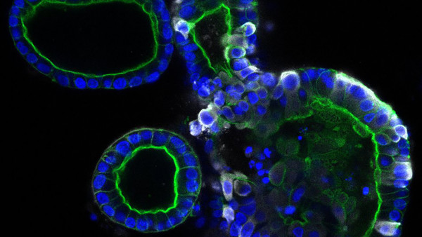 Bacterias del intestino podrían afectar la respuesta inmune al covid-19 e influir en su gravedad, según nuevos estudios » Ñanduti