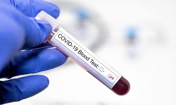 Salud reporta 14 finados por coronavirus y 1.002 contagiados