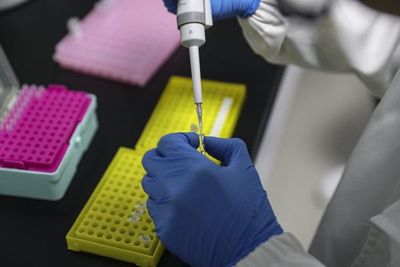 Inmunidad contra el COVID se da un mes después del contagio o la vacunación  - Nacionales - ABC Color