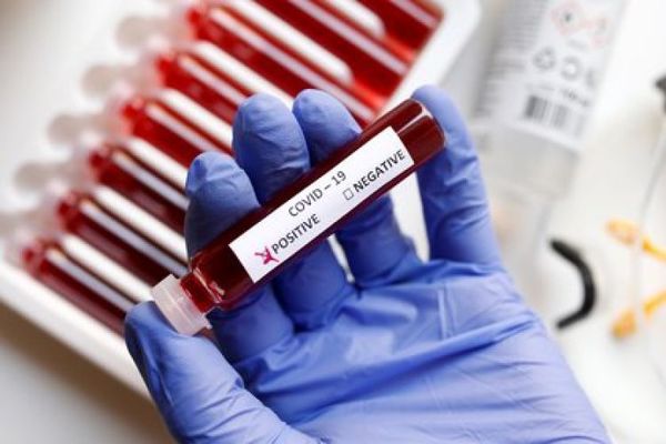 Salud informa sobre 16 nuevas muertes y 859 contagios de coronavirus