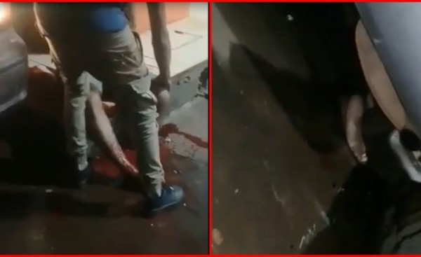 Arrolló a su amigo con su propio vehículo y le arrancó un pie