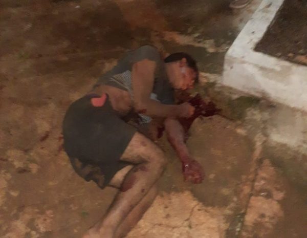 Atropellan a motochorros tras intento de asalto