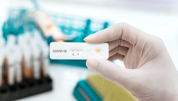 Salud reporta 771 contagios y 17 nuevas muertes por coronavirus