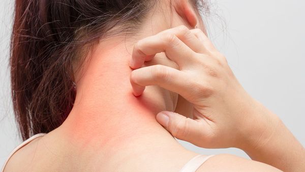 ▶ | Prurito senil, eczema y dermatitis atópica: 3 problemas en la piel que afectan la calidad de vida