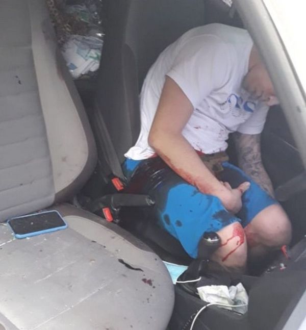 Atentan contra la vida de un joven en Jardín Aurora