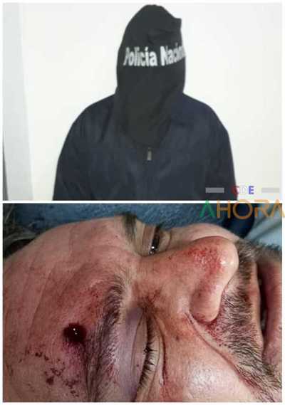 Detienen a SEGURIDAD que DISPARO contra un URUGUAYO